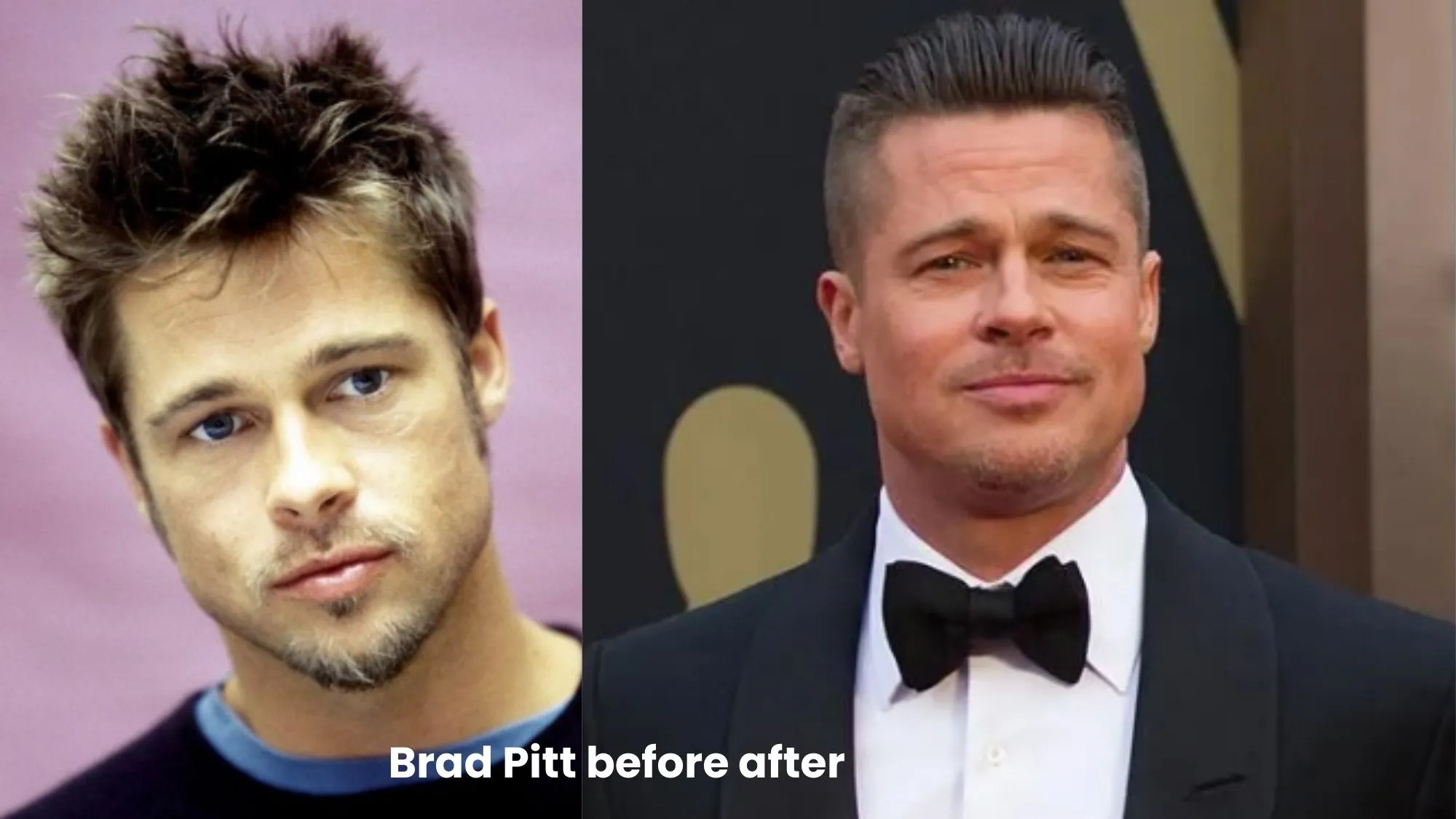 Brad Pitt hair transplant