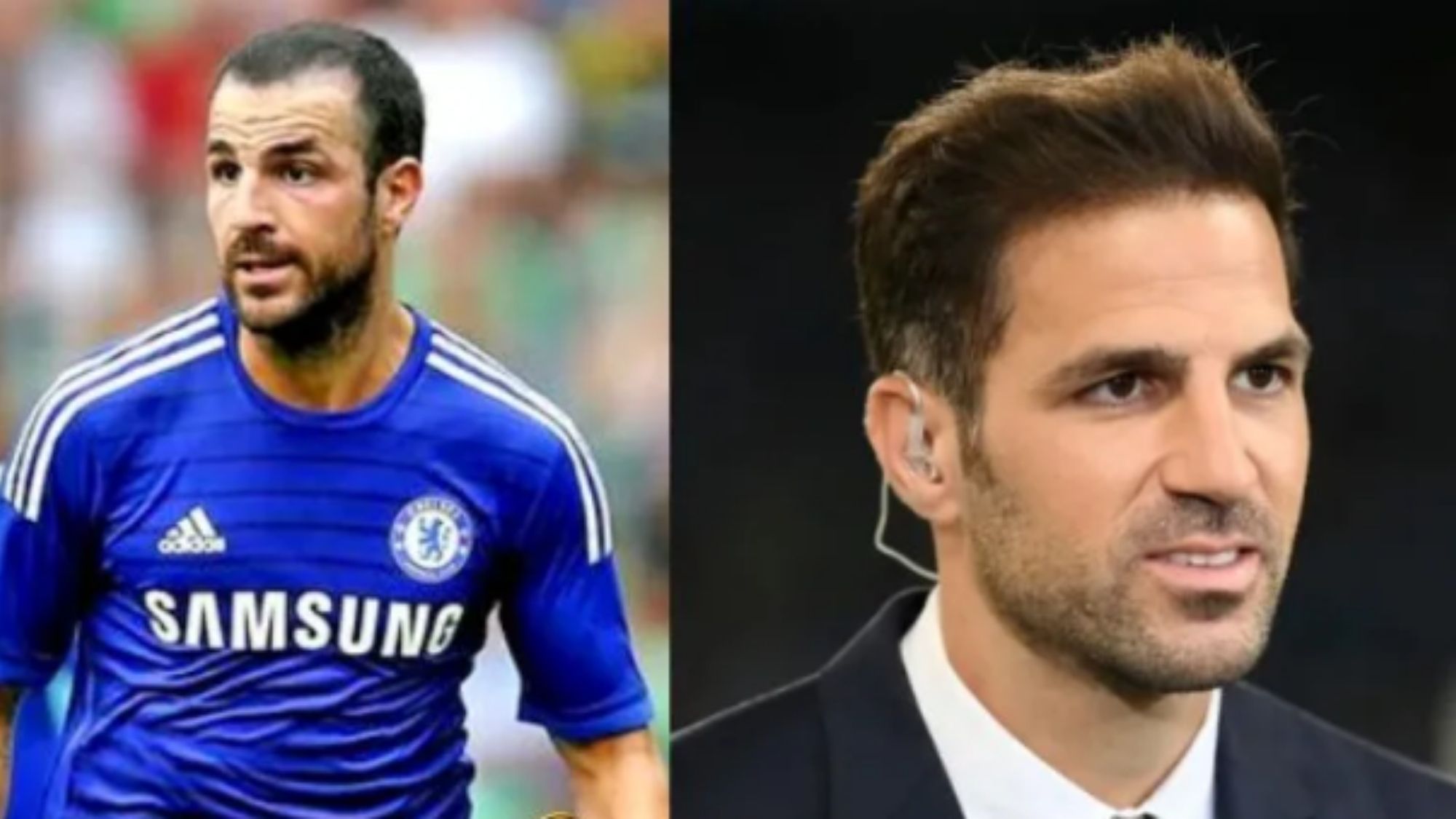 Cesc Fabregas hair transplant