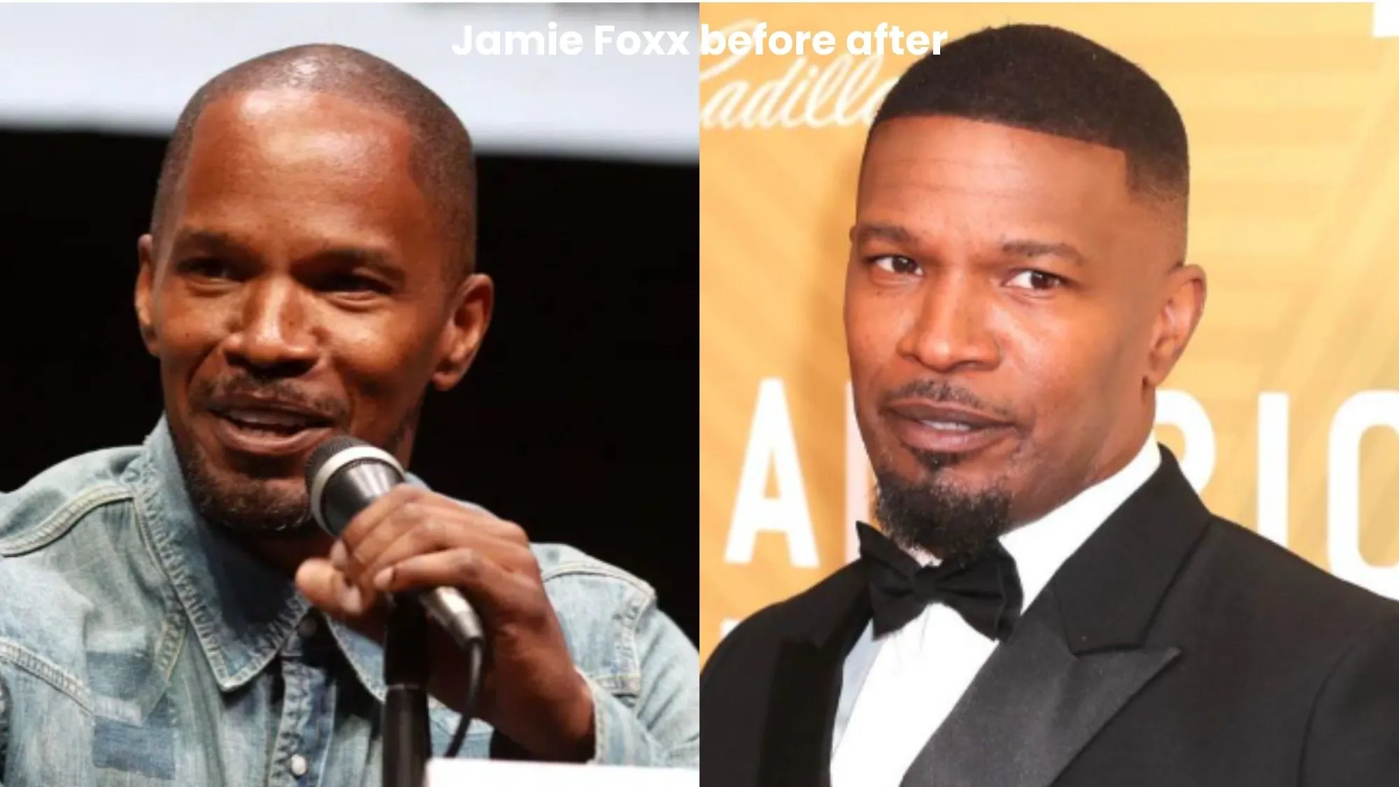 Jamie Foxx hair transplant