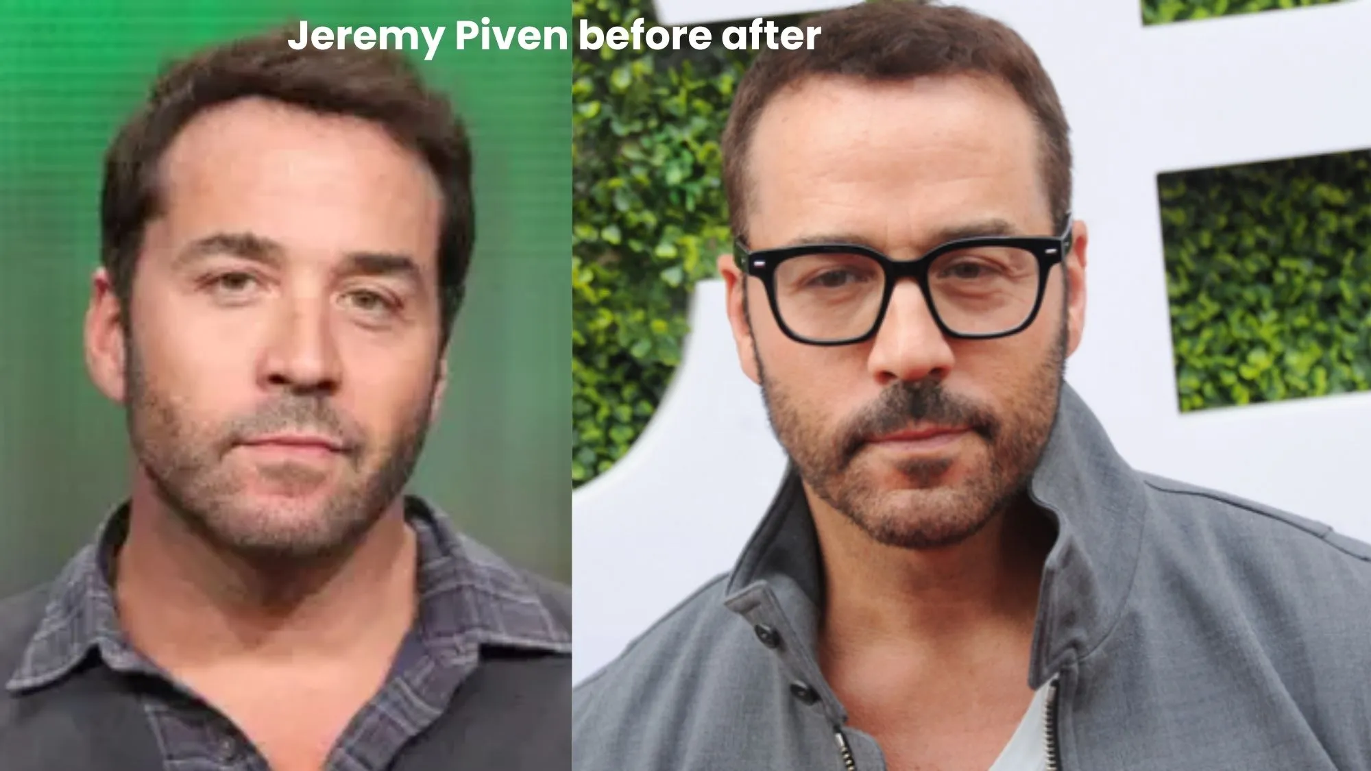 Jeremy Piven hair transplant