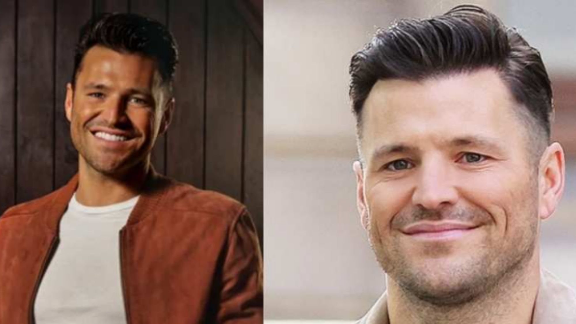 mark wright hair transplant