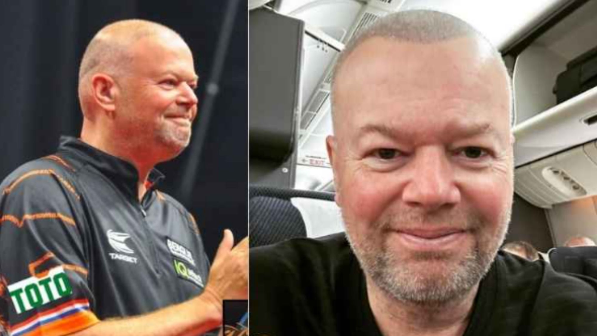 Raymond Van barneveld hair transplant