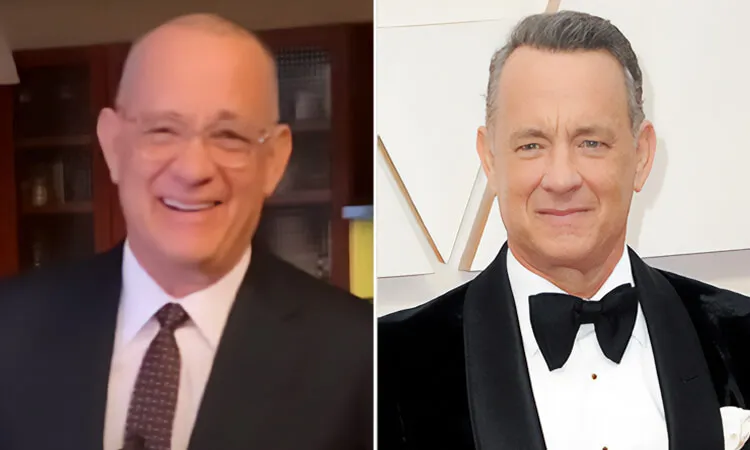 tom-hanks-hair-transplant