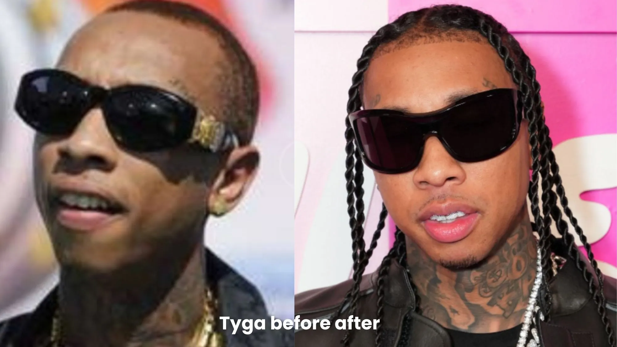 Tyga"